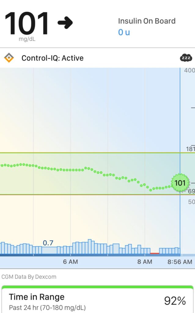 Improved Insulin Sensitivity from Watching Fat